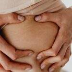 Stretch Marks & Weight loss - A Thorough Guide Stretch Marks anad weight loss